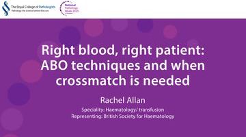 Rachel Allan_thumbnail