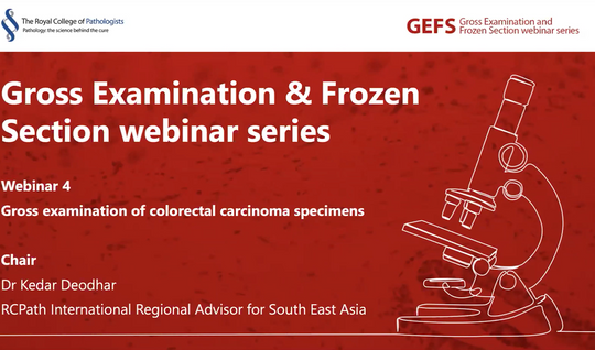 Gross examination of colorectal carcinoma specimens