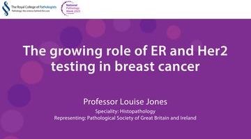 Professor Louise Jones_thumbnail