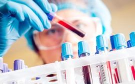 Female scientist handling blood sample tubes resized.jpg