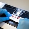Image of College calls for antenatal screening for hepatitis C virus 