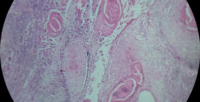 a report of histopathology