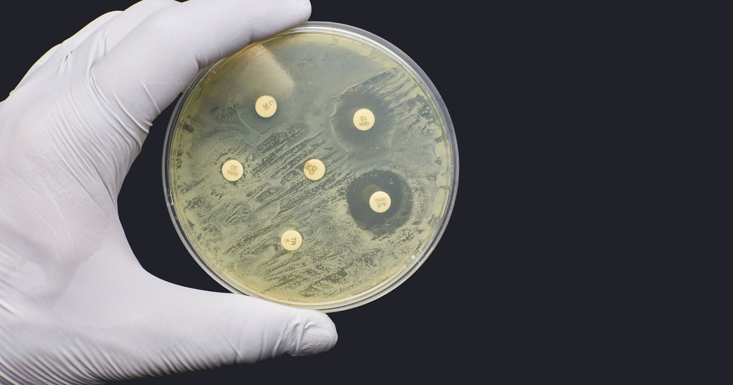 Hand holding up a petri dish of antimicrobial susceptibility resistance test by diffusion