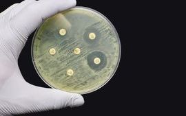 Antimicrobial-susceptibility-resistance-test-by-diffusion-on-black-background_rs.jpg