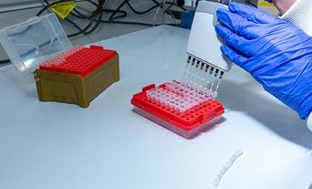 Pipetting image 6-North West Cancer Research Centre-11.2019 thumbnail.jpg