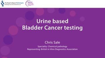 Urine based Bladder Cancer testing_thumbnail