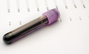 Test tube with blood on top of test results.jpg