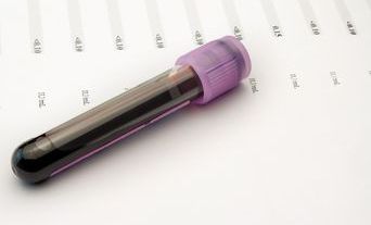 Test tube with blood on top of test results.jpg