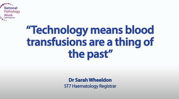 Technology means blood transfusions are a thing of the past_thumbnail