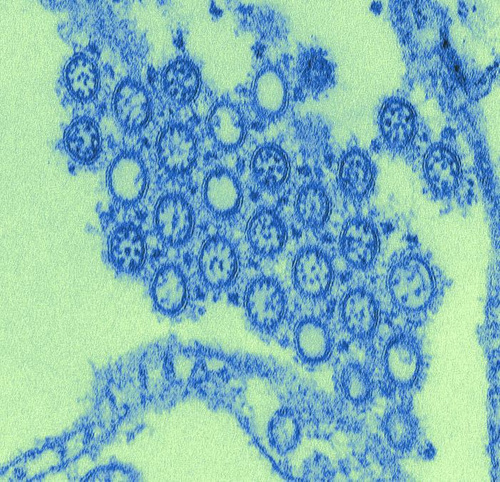 Electron microscope image of influenza viruses