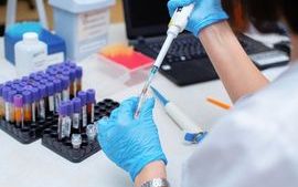 Blood testing in laboratory.jpg