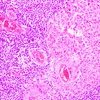 Image of Recommendation on the use of tumour staging systems from the College's Working Group on Cancer Services (October 2025)