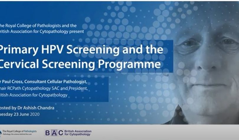 Primary HPV Screening and The Cervical Screening Programme -23  JUNE 2020