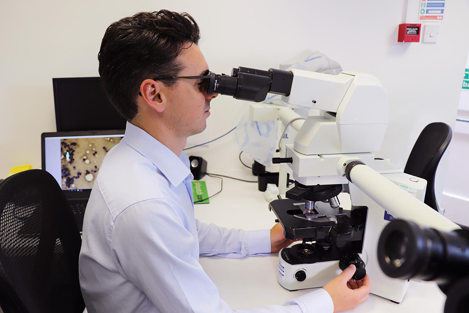 Alex Civello uses his microscope to diagnose issues such as iridociliary adenoma, a benign tumour like the one found in Crumble’s eye