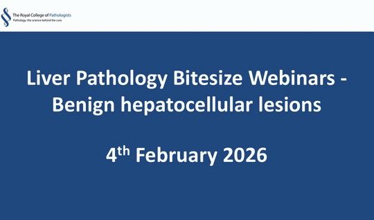 Liver Pathology Bitesize Webinars Benign hepatocellular lesions 