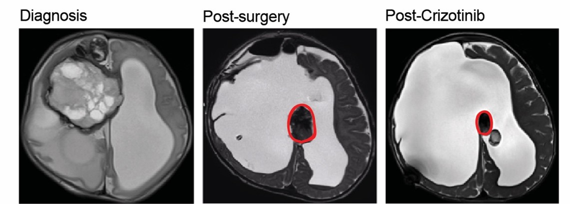 MRI scans_Matt Clarke.jpg
