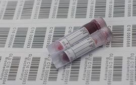 Blood tube image 1-Trafford General Hospital Laboratory-04.2016r.jpg