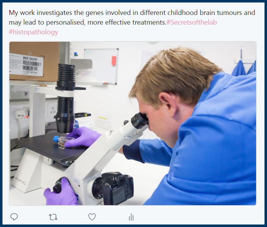 My work investigates the genes involved in different childhood brain tumours and may lead to personalised, more effective treatments. #histopathology #secretsofthelab