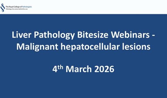 Liver Pathology Bitesize Webinars - Malignant hepatocellular lesions
