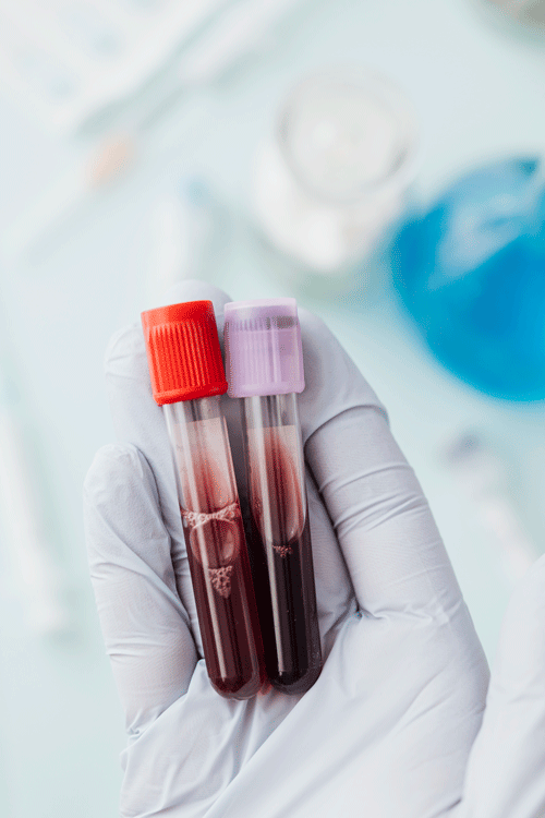 A person holding blood sample tubes in their hand.