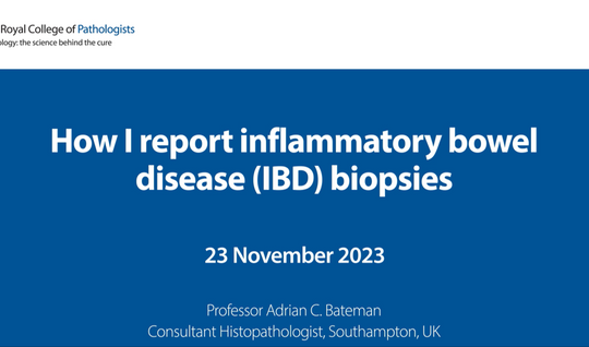 How I report inflammatory bowel disease (IBD) biopsies