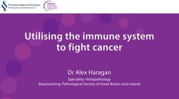 Using the immune system to fight cancer, Dr Alex Haragan_thumbnail