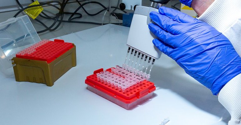 Pipetting image 6-North West Cancer Research Centre-11.2019 copy.jpg