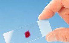blood_slide_microbiology_virology_haematology_28878664_340x305px.jpg