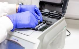 Liverpool ocular pathology molecular science