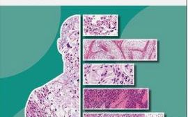Diagnostic Pathology - Soft Tissue Tumours book cover.jpg