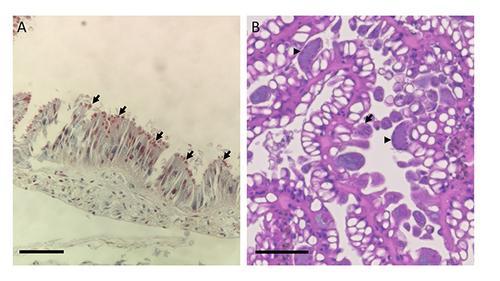 Two slides showing parasites in Partula snails.