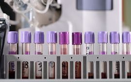 test_tubes_chemical_pathology_33449081_785x400px.jpg