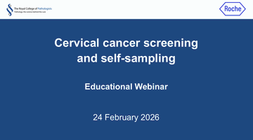 Cervical cancer webinar thumbnail (Roche)