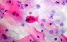 cyto_h_cochrane_cytopathology_785x400.jpg