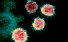 COVID-19 coronavirus particles TEM-SPL red small
