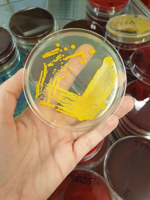 Agar plate showing colonial growth of a Staphylococcus aureus (a bacteria that can cause a wide range of severe infections.)