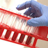 Image of Royal College of Pathologists welcomes new cancer blood test trial