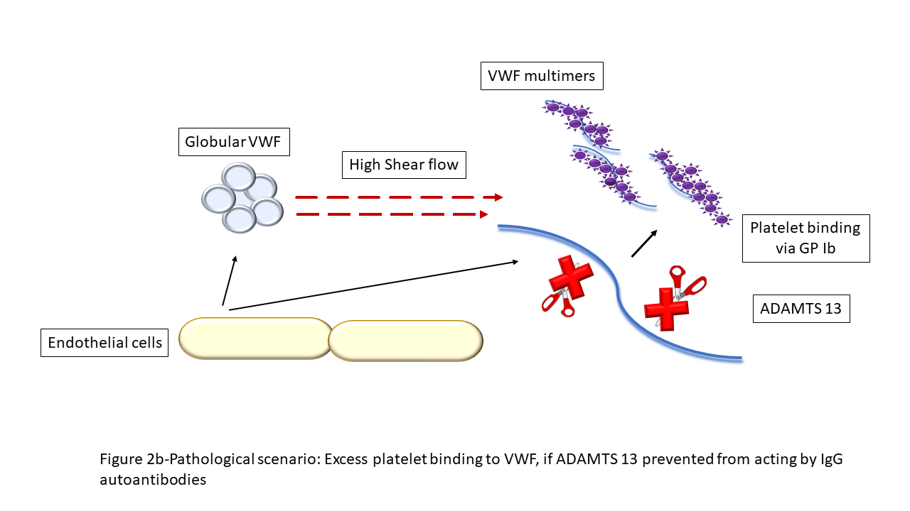 Figure 2b. Pathological scenario: Excess platelet binding to VWF, if ADAMTS 13 prevented from acting by IgG autoantibodies.10VWF: von Willebrand factor